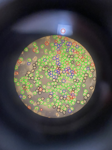 Image of early-stage shellfish larva, or seed, under a microscope with colored circles to highlight healthy seed in green, and unhealthy or nonliving seed in black, red, and blue.